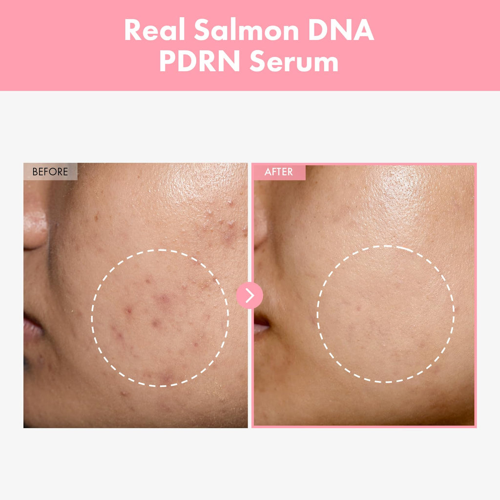TOSOWOONG Pink Peptide 12 PDRN Serum With Salmon DNA PDRN 10,320ppm, 12 Peptides 1.11 fl.oz.