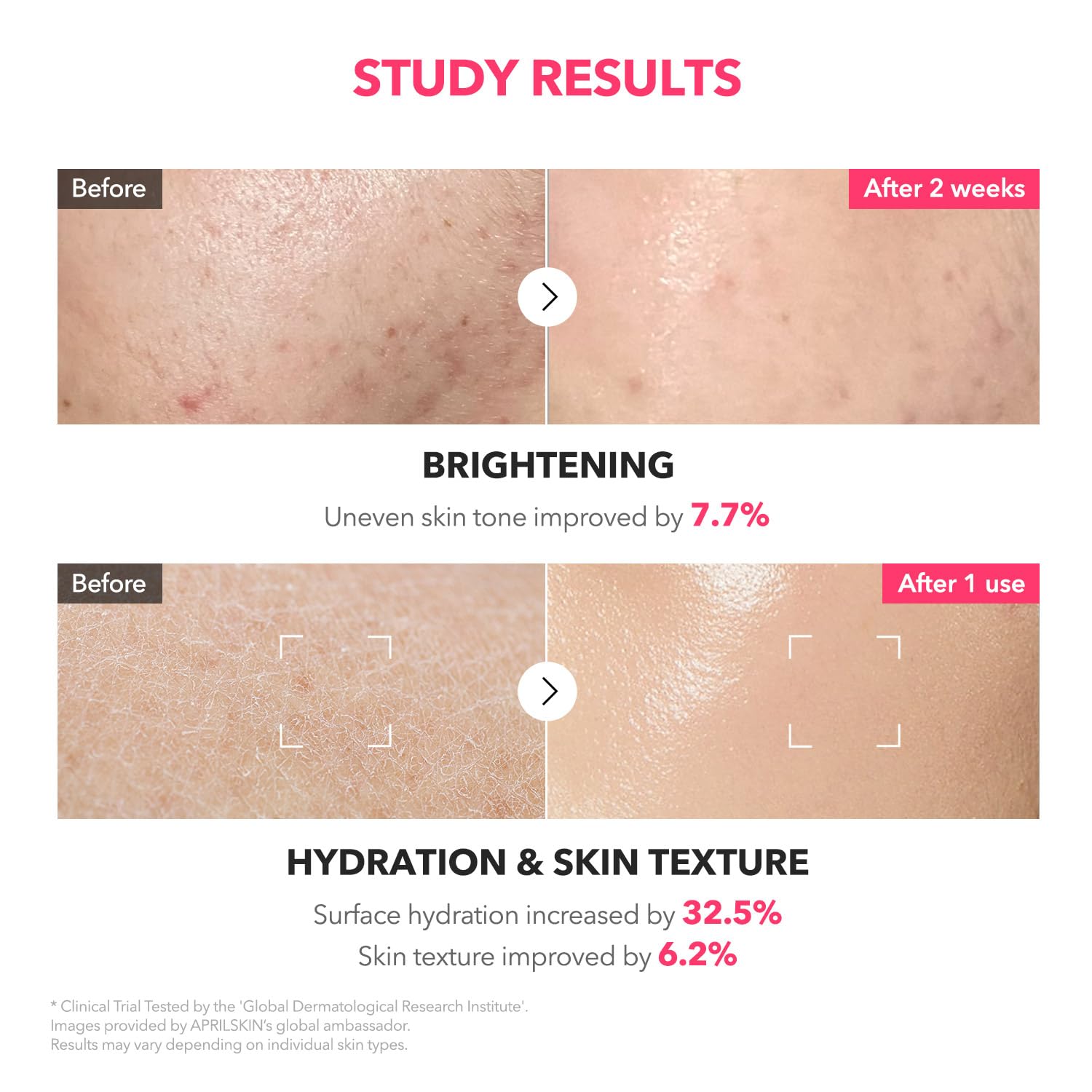APRILSKIN TXA+Niacinamide 99 Pink Milky Toner | 99% High-Purity | 5.07 fl.oz.